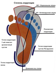 Детская ортопедическая антиварусная обувь