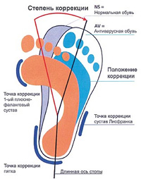 антиварусная обувь